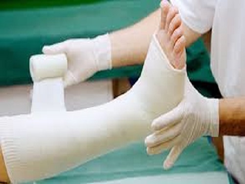 Chữa nứt xương bằng xương nhân tạo