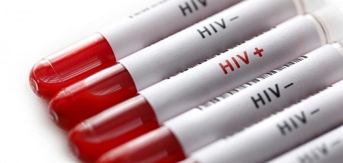 hiv lay nhiem duong nao
